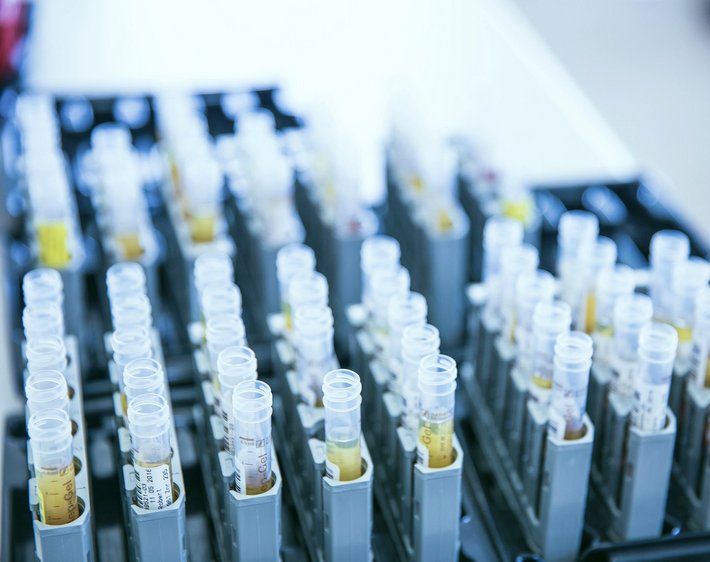 Abbildung von unterschiedlichen Proben im Labor aufgereiht